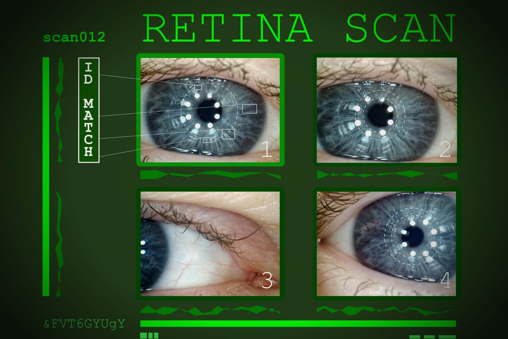 retina-occhio-scansione-patologie-clinica-marchetti-oculista.jpg
