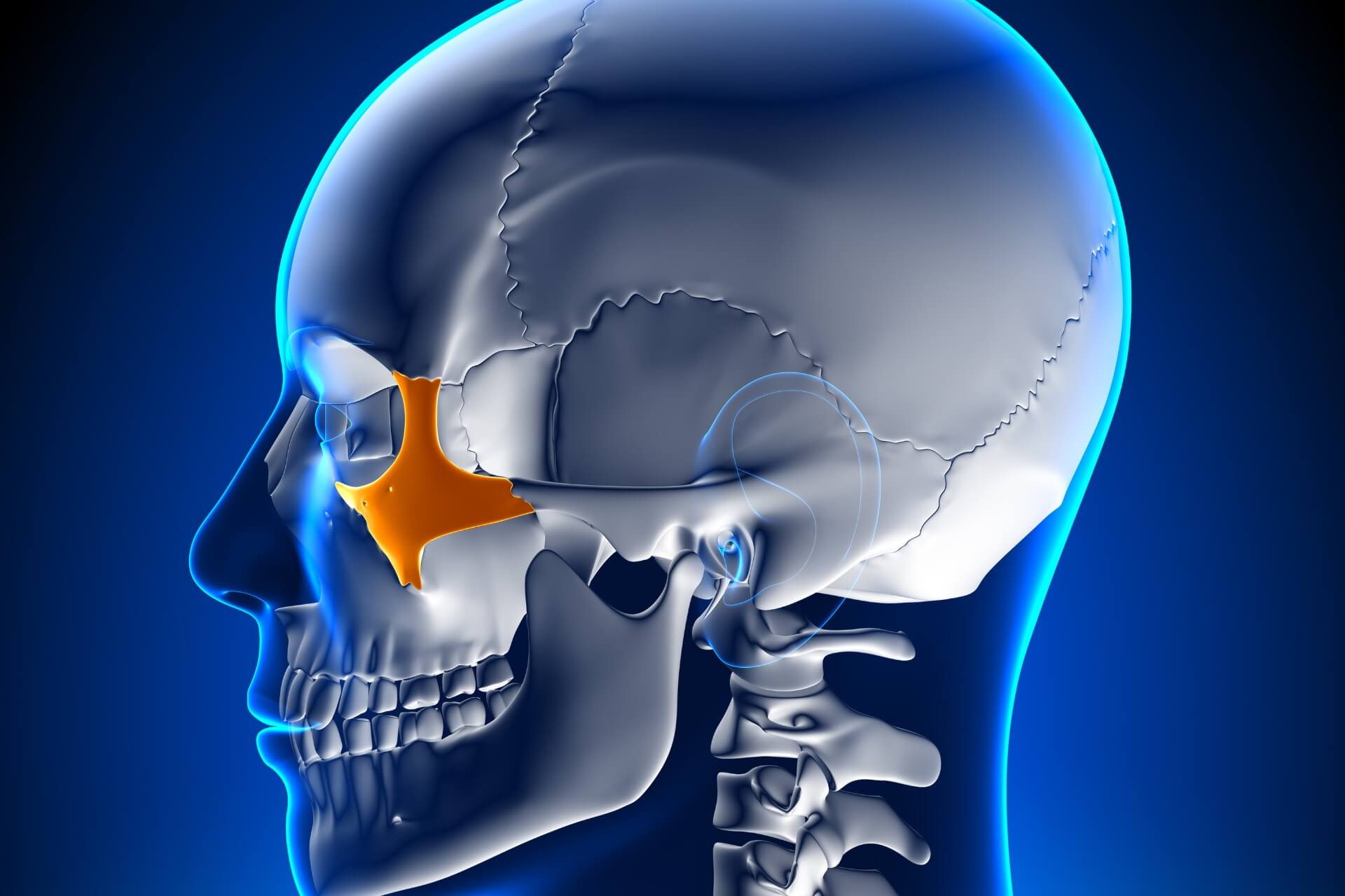 impianti-dentali-zigomatici-riabilitazioni-osso-assente.jpg