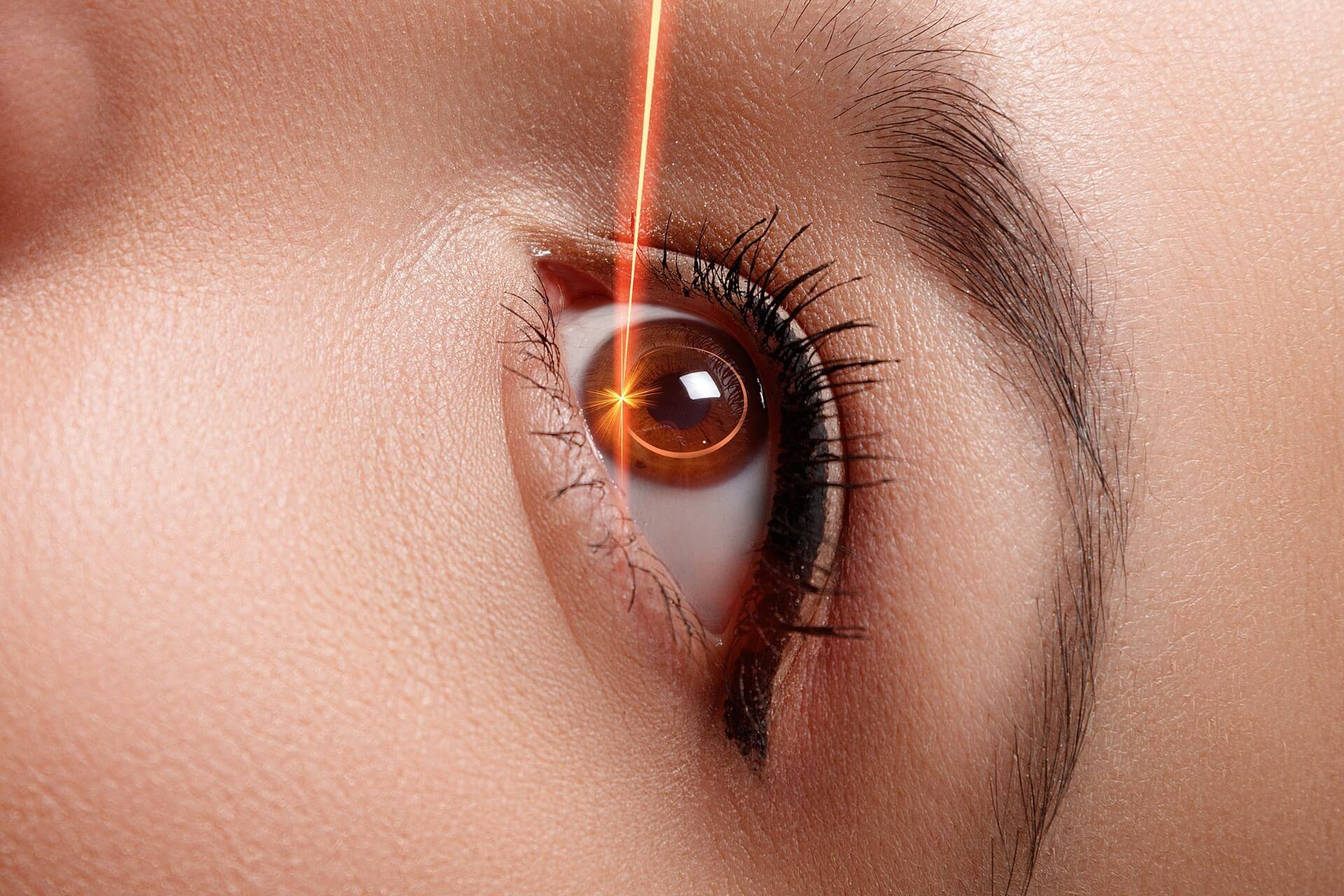 chirurgia laser per risolvere la miopia e difetti visivi