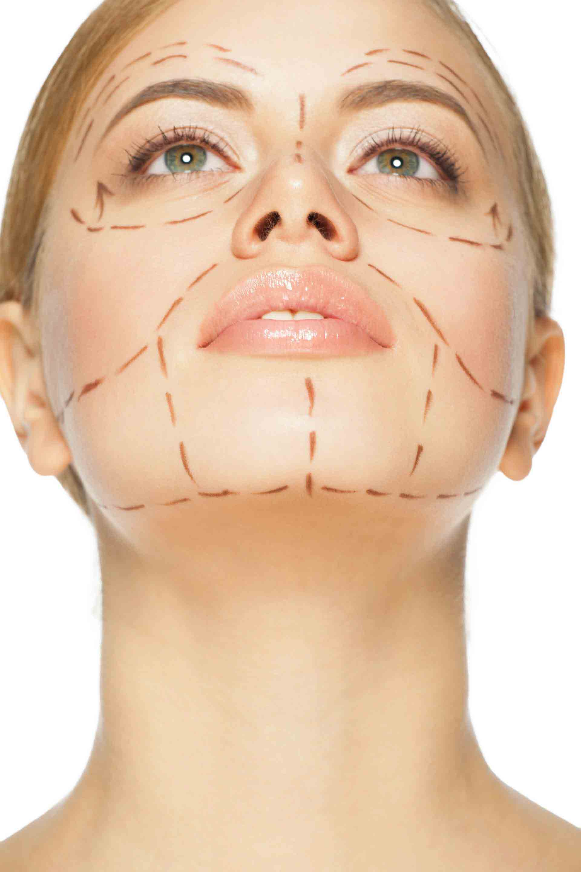 Ridare elasticità alla pelle del viso con il lifting