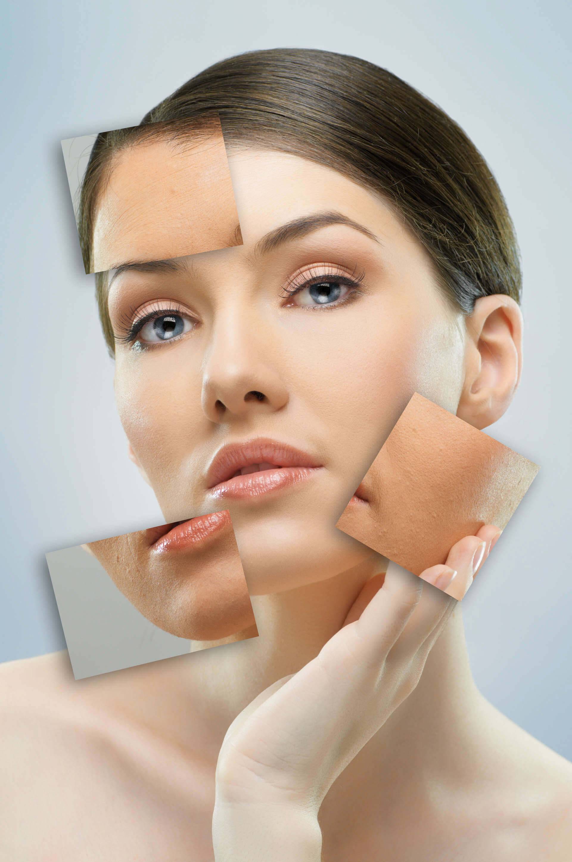 Il peeling elimina le imperfezioni della pelle del volto