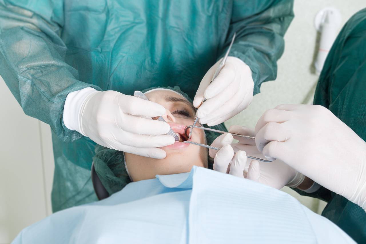 Interventi di chirurgia orale