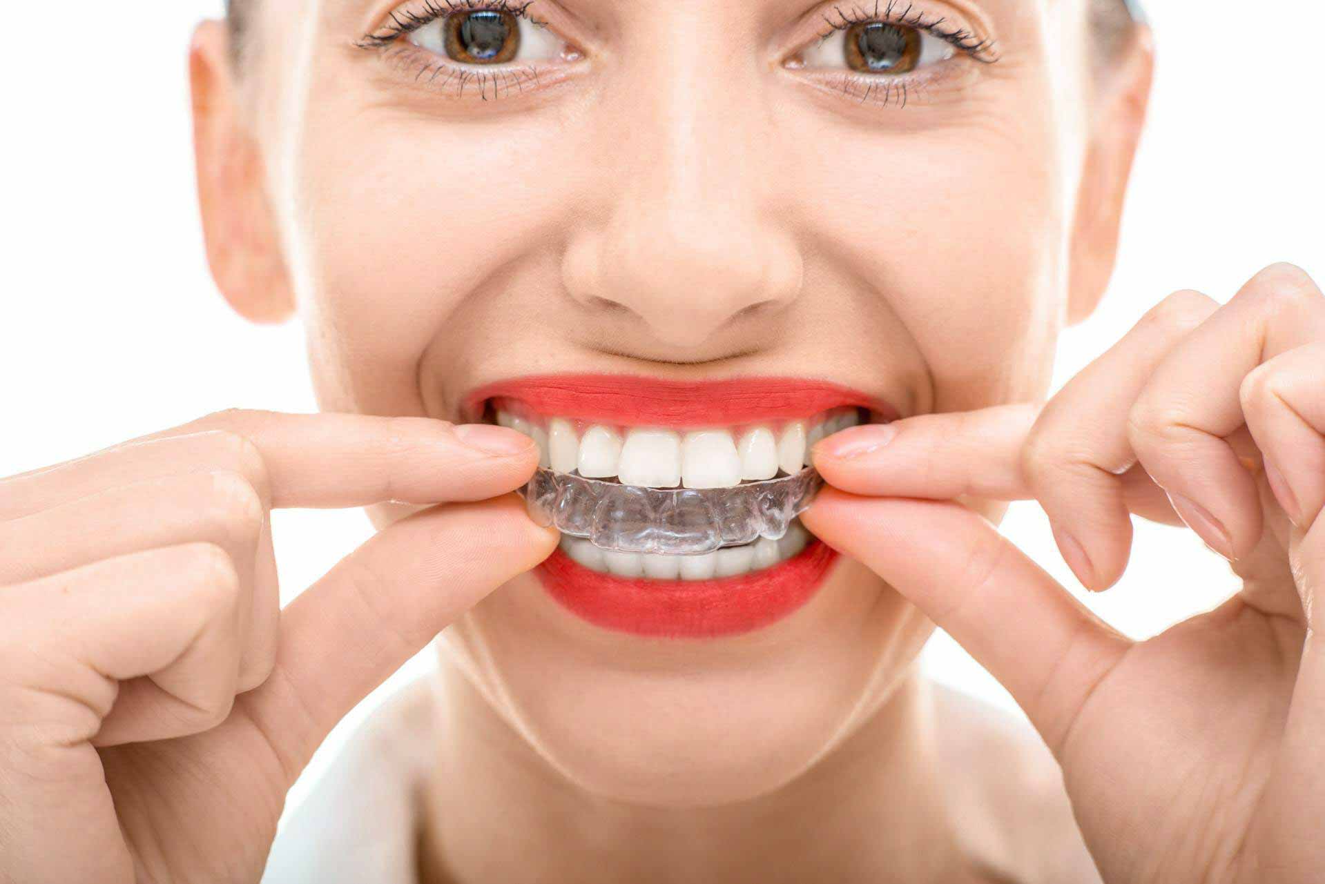 Teeth Whitening Method Considerations