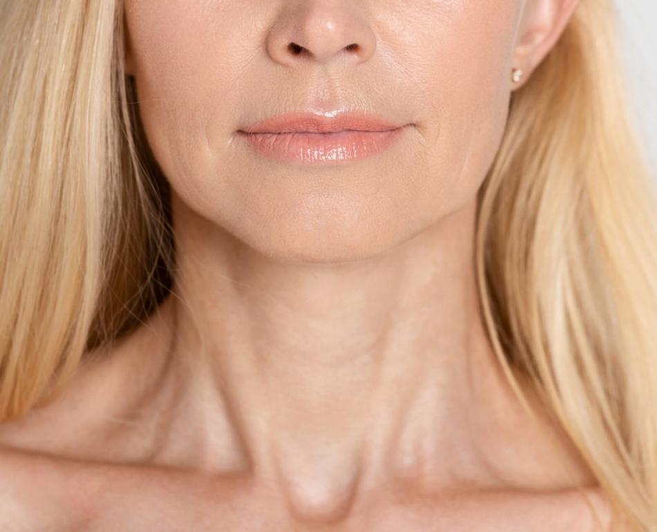 rimedi per le rughe sul collo