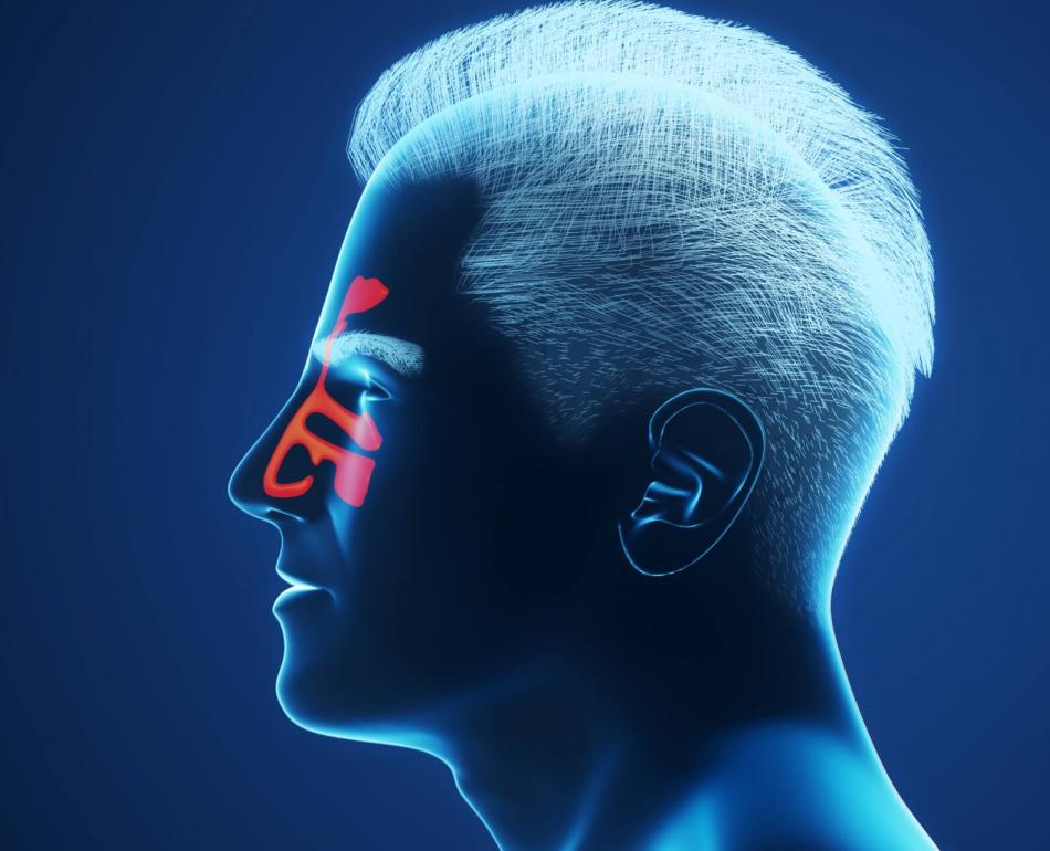 sintomi di raffreddore, rinite e sinusite che interessano i seni paranasali