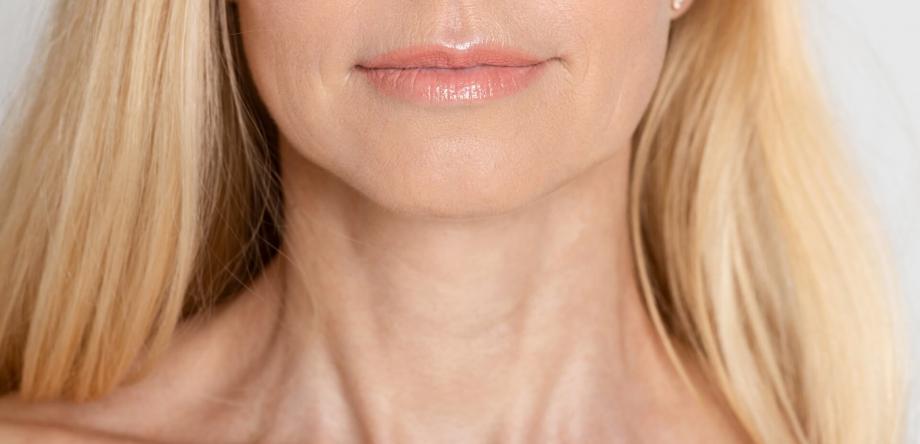 rimedi per le rughe sul collo