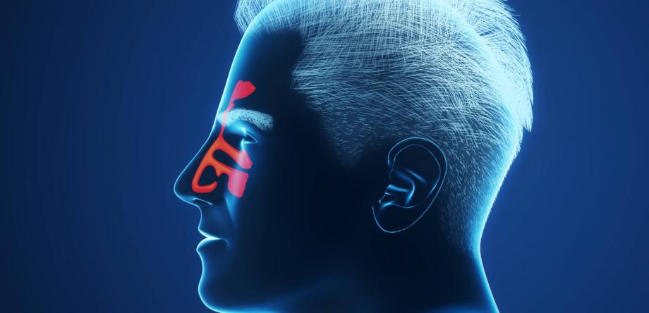 sintomi di raffreddore, rinite e sinusite che interessano i seni paranasali