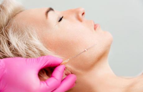 lifting con fili biostimolanti per ringiovanimento pelle e viso
