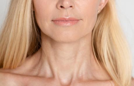 rimedi per le rughe sul collo