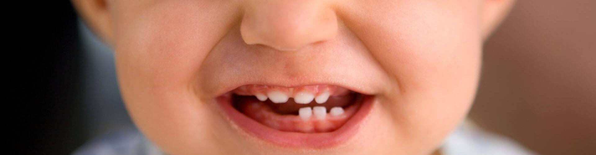 denti da latte nei bambini