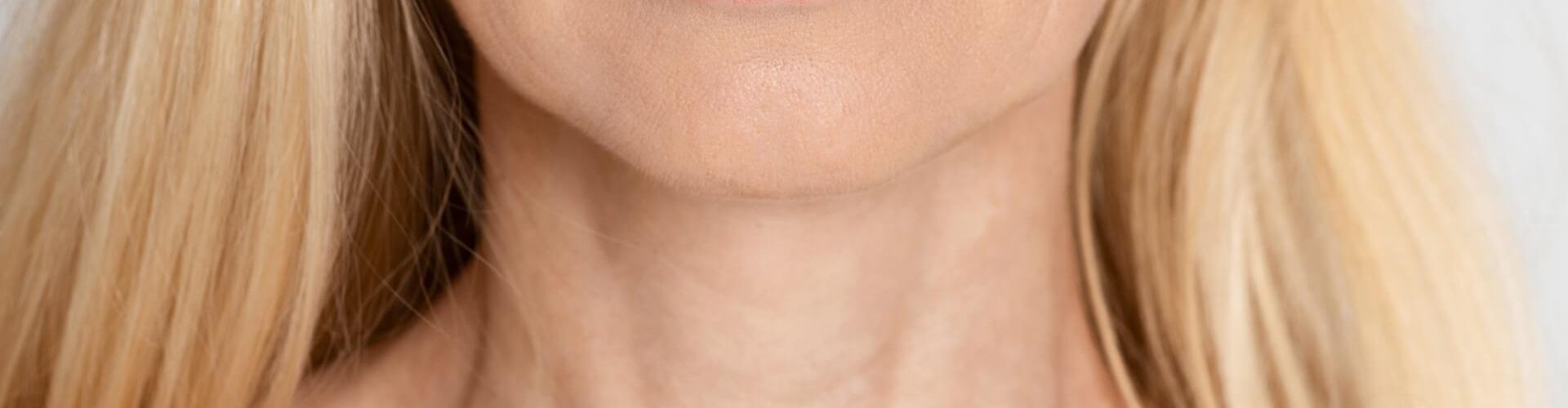 rughe del décolleté come cancellarle