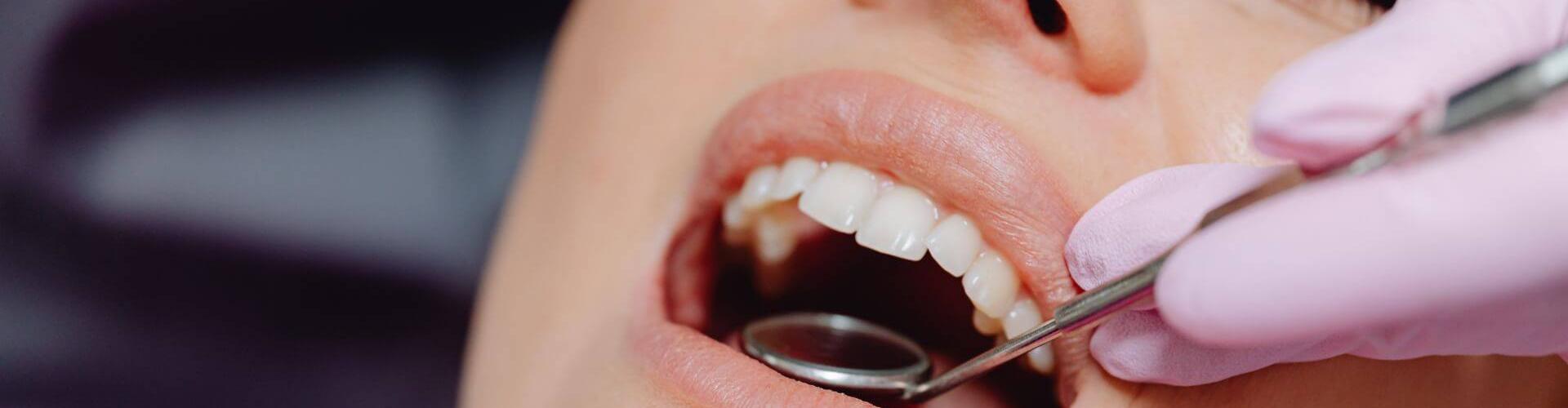 odontoiatria conservativa per la cura di carie e denti scheggiati