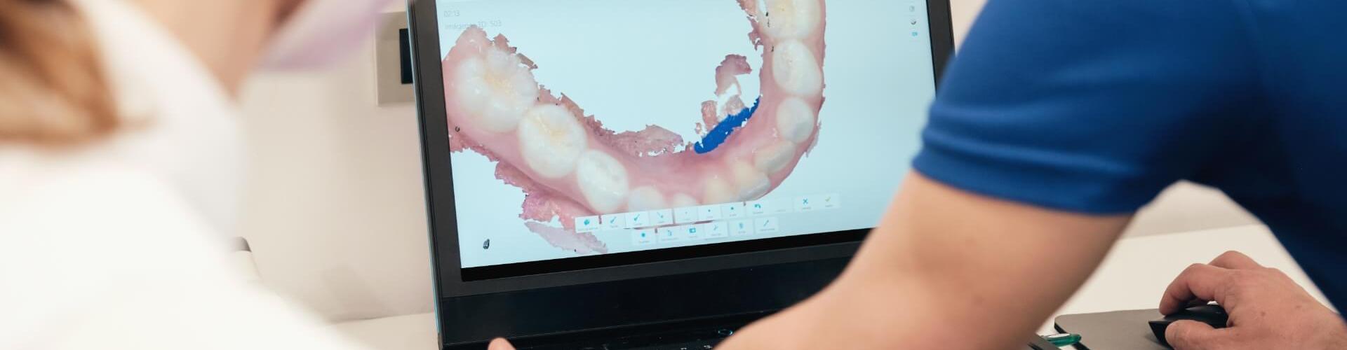 digital dentistry - odontoiatria digitale