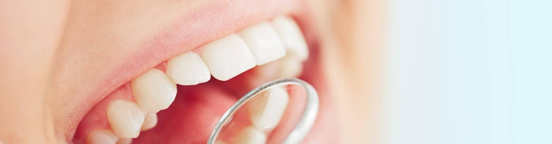 Odontoiatria mininvasiva